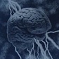 Νευρολογία-Ψυχιατρική- Ηλεκτρομαγνητισμοί και ευφυΐα
