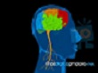 Νευρολογία-Ψυχιατρική- Εγκεφαλικά αγγεία και λοιμώξεις